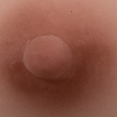 #5 Areola Color