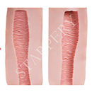 Type A Vaginal Texture