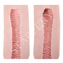 Type B Vaginal Texture