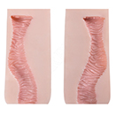 Type C Vaginal Texture