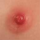 Areola Color Red