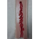 #10 16.5 cm (6.5 in) Vaginal Style