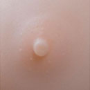 Skin Areola