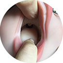 Fixed Tongue Type