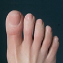 Detailed Skin Texture