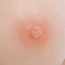 #12 Areola