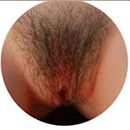 #2 Pubic Hair