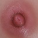 #8 Areola Color