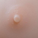 Skin Areola