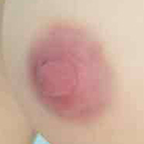 Areola Color Y3
