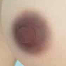 Areola Color Y4