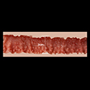 3cm Anal Diameter