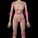 General Weakness Joint Tightness