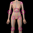 General Weakness Joint Tightness