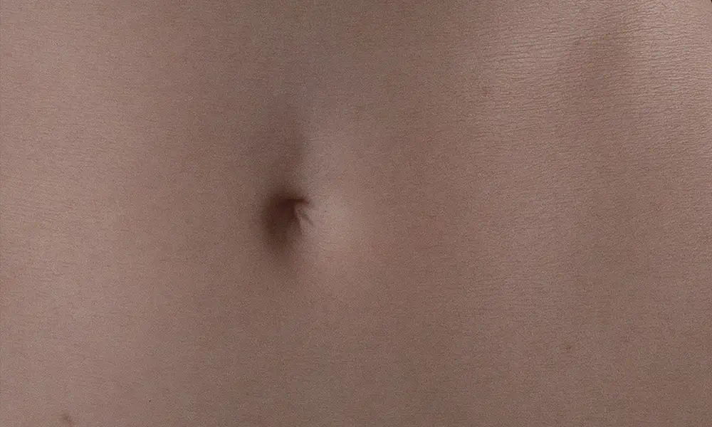 belly skin texture