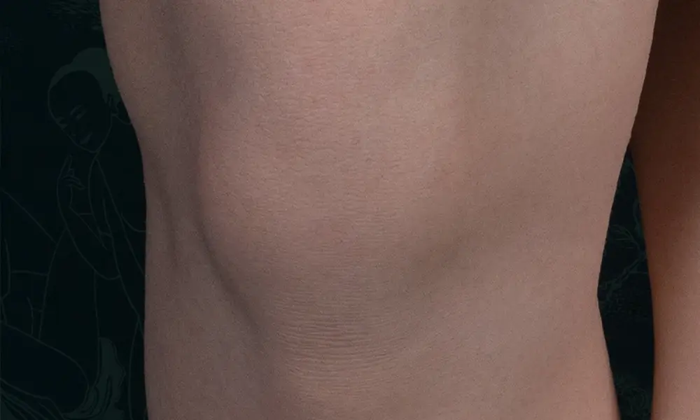 knee skin texture